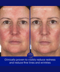 Augustinus Bader The Hydrogel Face Mask