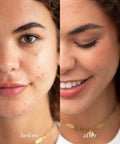 Ere Perez Arnica Concealer