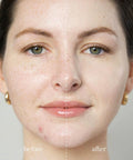 Ere Perez Arnica Concealer