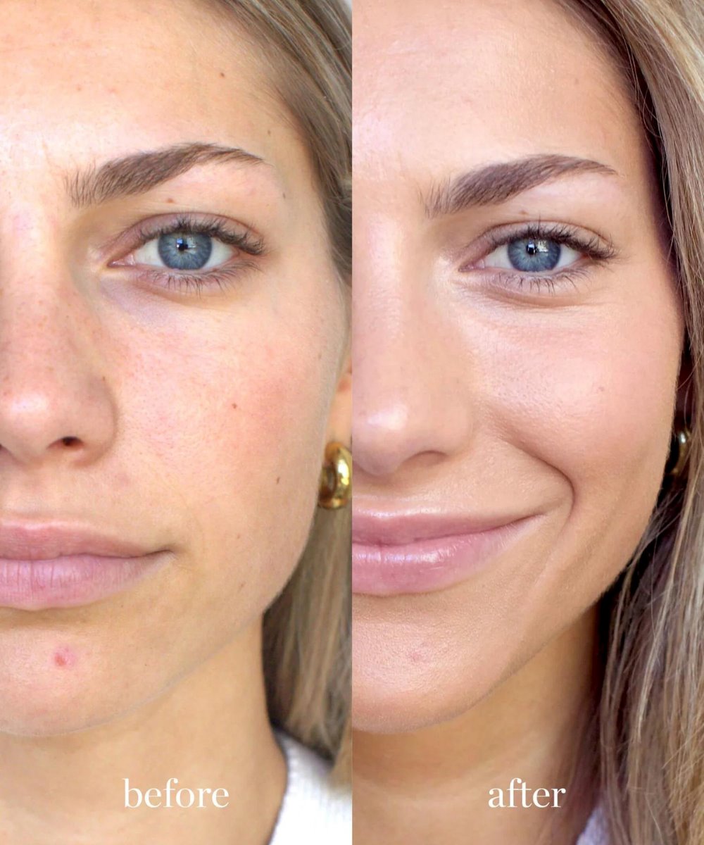 Ere Perez Arnica Concealer