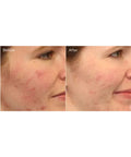 Murad Clarifying Cleanser