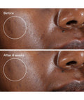 Murad Rapid Dark Spot Correcting Serum