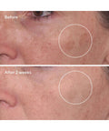 Murad Rapid Dark Spot Correcting Serum