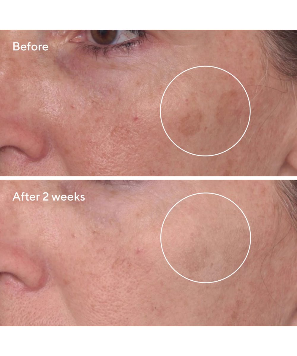 Murad Rapid Dark Spot Correcting Serum