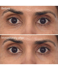 Murad Retinol Youth Renewal Eye Masks