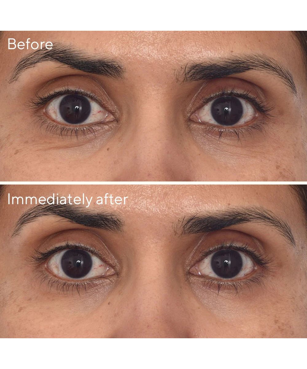 Murad Retinol Youth Renewal Eye Masks