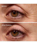 Murad Retinol Youth Renewal Eye Serum
