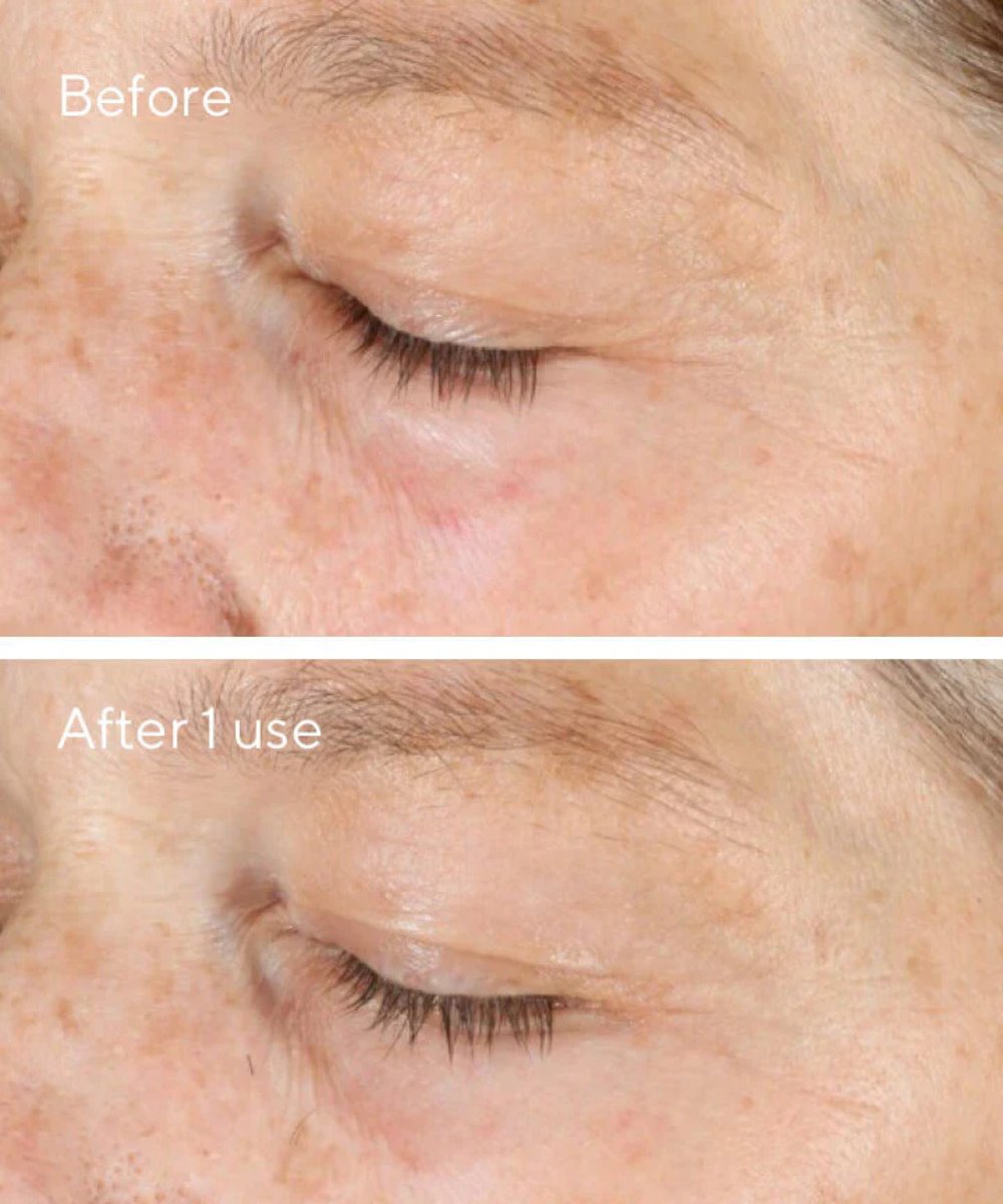 Murad Vita-C Triple Exfoliating Facial