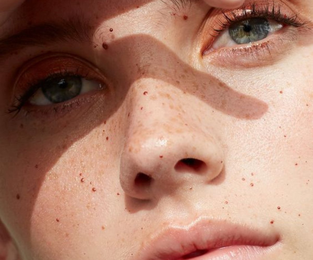 The best skincare ingredients for acne-prone skin