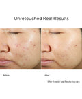 Murad Invisiscar Resurfacing Treatment 